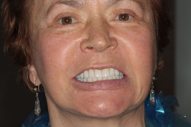 Афонина Алла Стефановна после стоматологического лечения