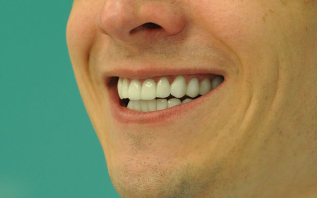 Мужчина после стоматологического лечения