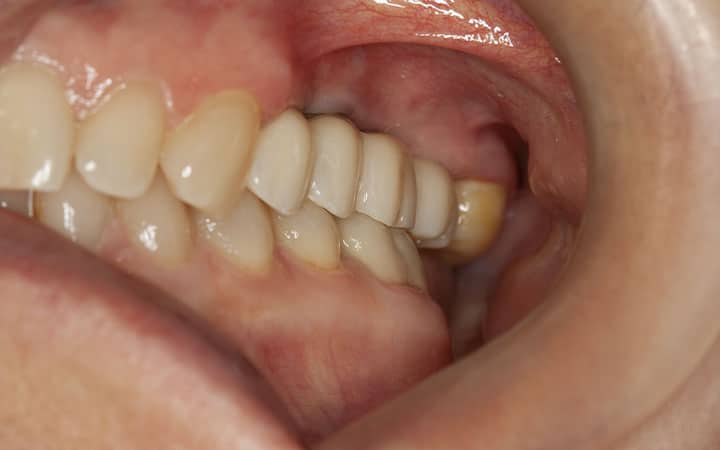 аверченкова после стоматолог лечения