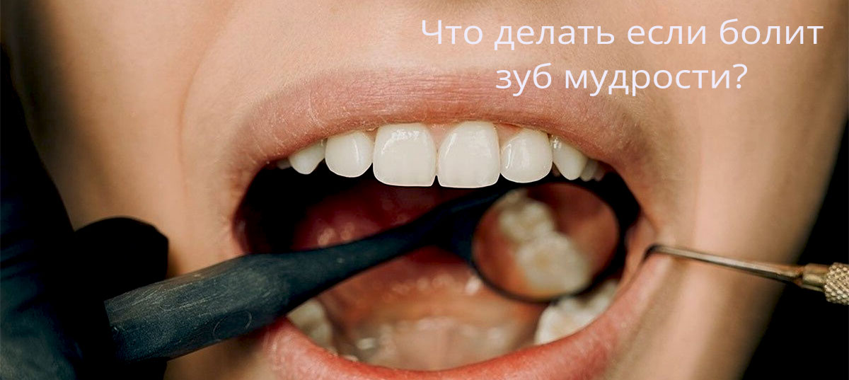Сложное удаление зубов мудрости в GMS Dental