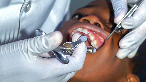 Что может вызвать абсцесса зуба