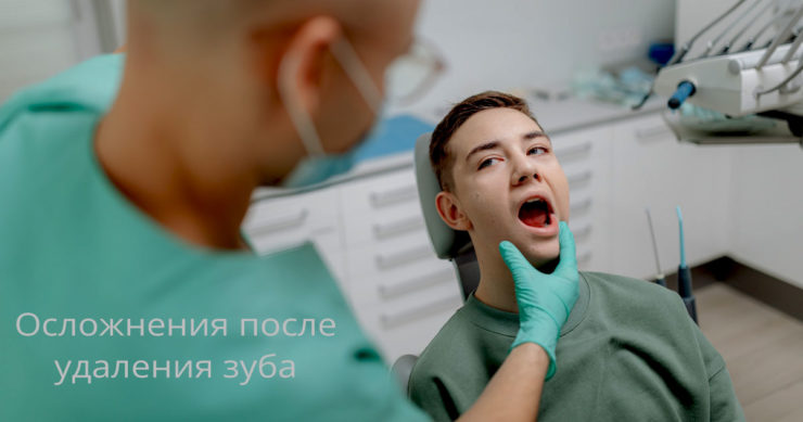 Осложнения после удаления зуба лечение в стоматологии