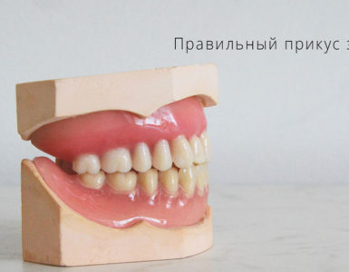 Правильный прикус зубов