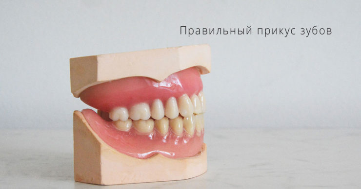 Правильный прикус зубов