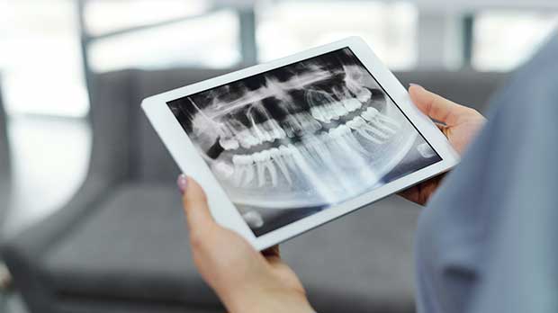 Что означает слабое смещение центра зубов?