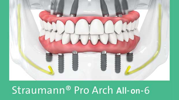 Straumann Pro Arch Имплантация All-on-6 Решение при полной адентии