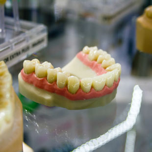 Уход и чистка зубных протезов из нейлона