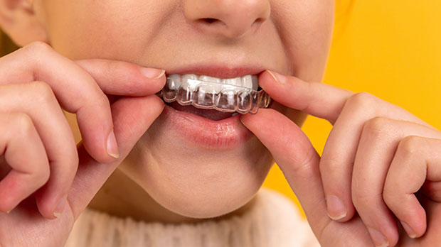 Что такое Ортотик в стоматологии?