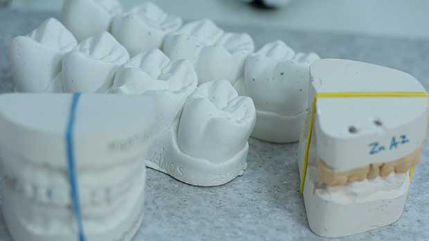 Как делают индивидуальные силиконовые зубные протезы в стоматологии? Силиконовые зубные протезы