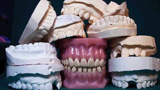 Какие основные виды и типы съемных зубных протезов бывают?