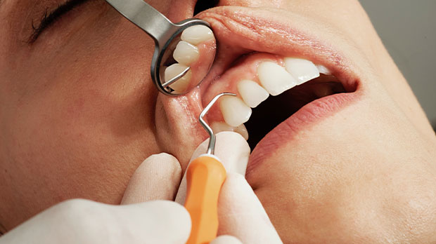 Что такое гиперестезия зубов простыми словами