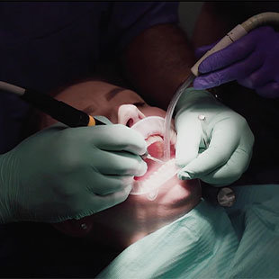 кариозные поражения зубов средний кариес