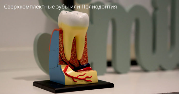 Причины появления сверхкомплектных зубов