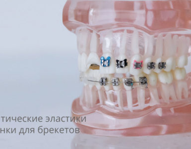 Ортодонтические эластики и резинки для брекетов