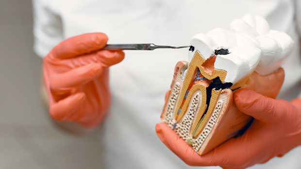 Что такое зубной нерв и для чего он нужен