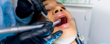 пломбирование зубов