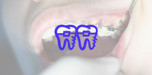 Консультация врача-ортодонта в стоматологии в Москве