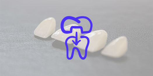 Коронки на зубы в стоматологии Протезирование зубов