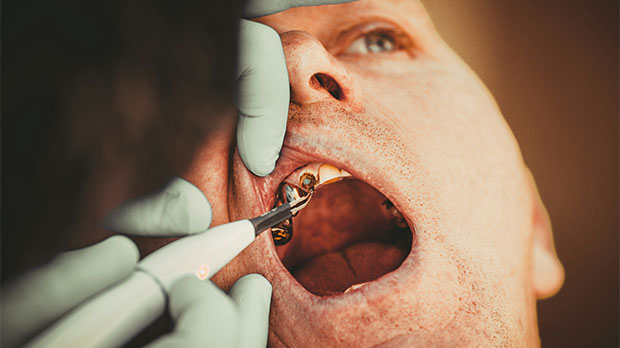 Относительные противопоказания для имплантации зубов