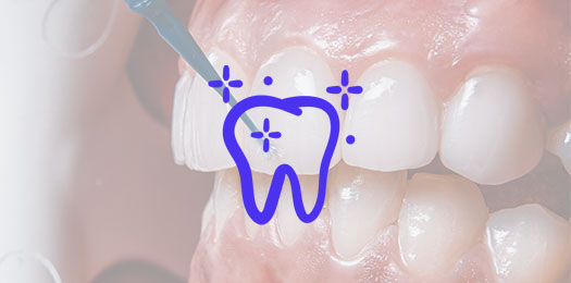 Профессиональная чистка зубов швейцарским протокол GBT