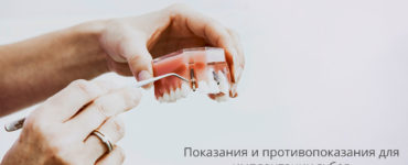 Показания и противопоказания для имплантации зубов