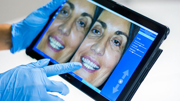 Преимущества установки импланта Astra Tech в стоматологии в Москве под ключ дешевле