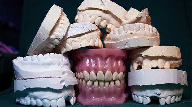 Ремонт зубных протезов в стоматологии
