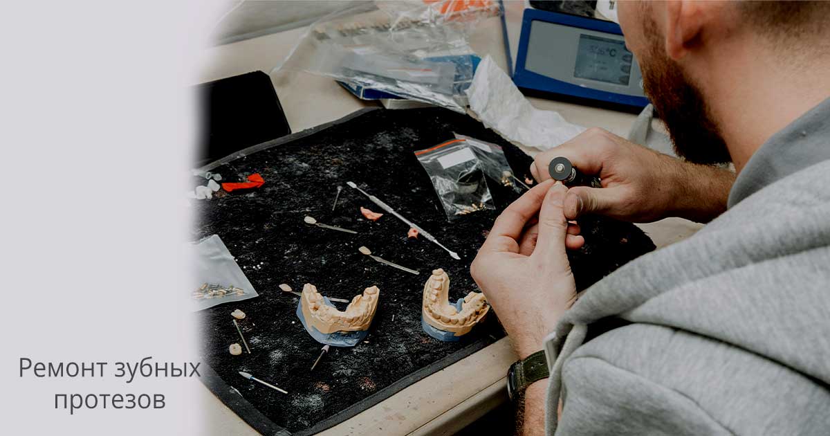 Срочный ремонт зубных протезов в Москве, дешево | Американский стоматологический центр Дантист