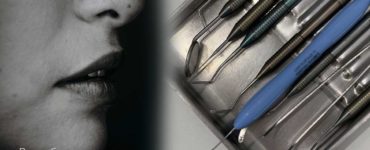 Вестибулопластика преддверие полости рта методика по кларку казанджану в москве