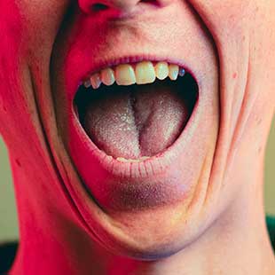Вестибулопластика преддверие полости рта методика по кларку казанджану