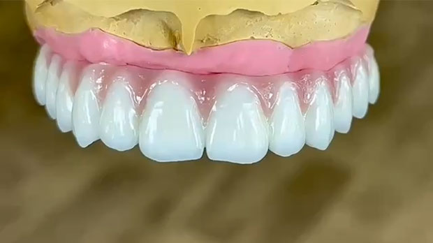 Альтернативные методы имплантация зубов верхней челюсти