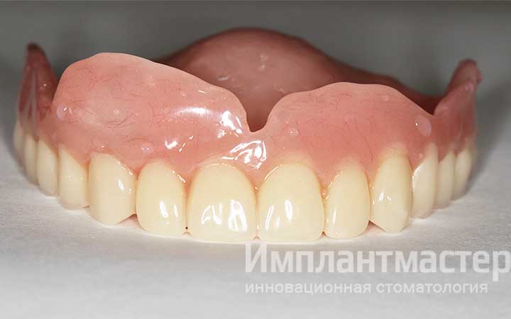 полный съёмный зубной протез фото отзывы пример ПОСЛЕ 2