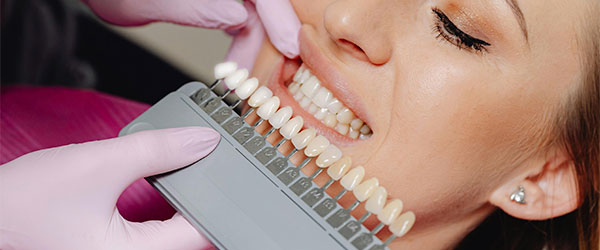 Отбеливание зубов услуги в стоматологии Имплантмастер