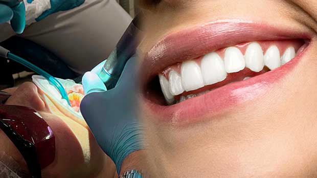 Что такое эстетическая стоматология эстетическая реставрация передних зубов