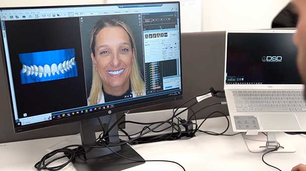 Цифровое моделирование улыбки (Digital Smile Design) ориентировано на клиента