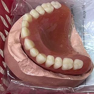 Этапы прямого моделирования зубов