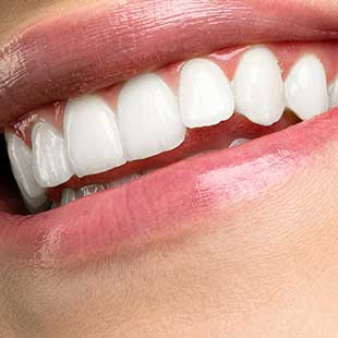 Виниры на зубы в центр эстетической стоматологии и имплантации