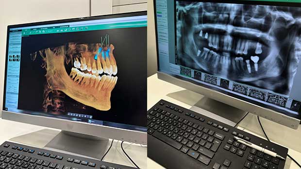 Отличия КТ от Ортопантомограмма, панорамный снимок зубов, ОПТГ