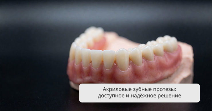 Акриловые зубные протезы: доступное и надёжное решение для восстановления улыбки