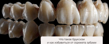 Что такое бруксизм и как избавиться от скрежета зубами