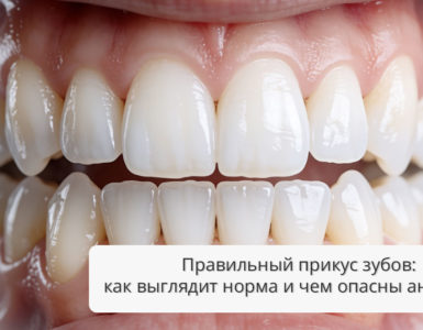 Правильный прикус зубов: как выглядит норма и чем опасны аномалии
