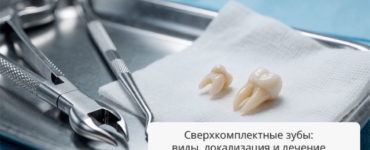 Сверхкомплектные зубы: виды, локализация и современные методы лечения