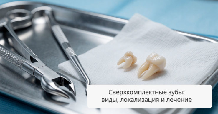 Сверхкомплектные зубы: виды, локализация и современные методы лечения